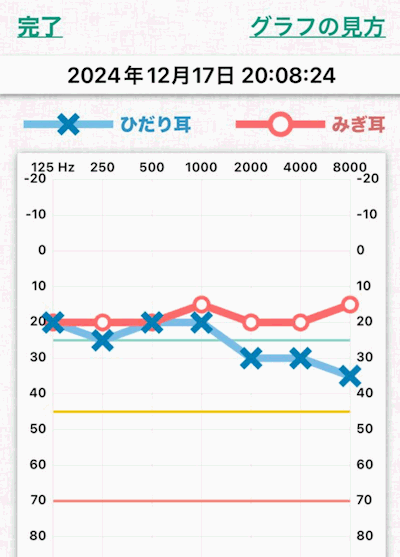 耳の聴力の低下
